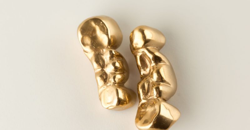 Thinking of Selling Your Dental Gold? Avoid These Six Mistakes